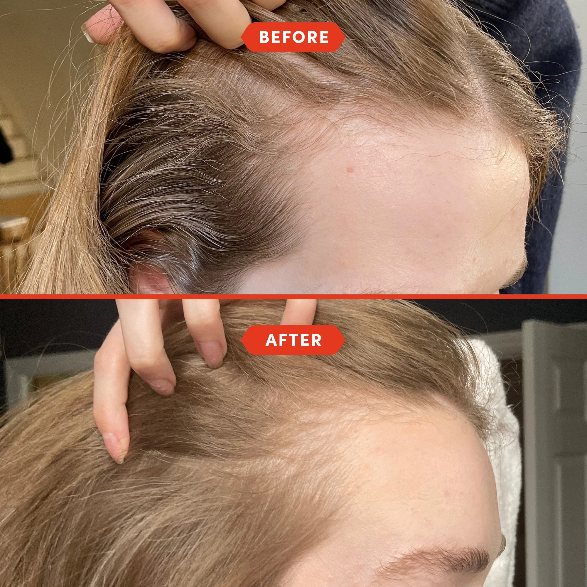 Strength & Shine Mini Hair Oiling Duo - Image 5