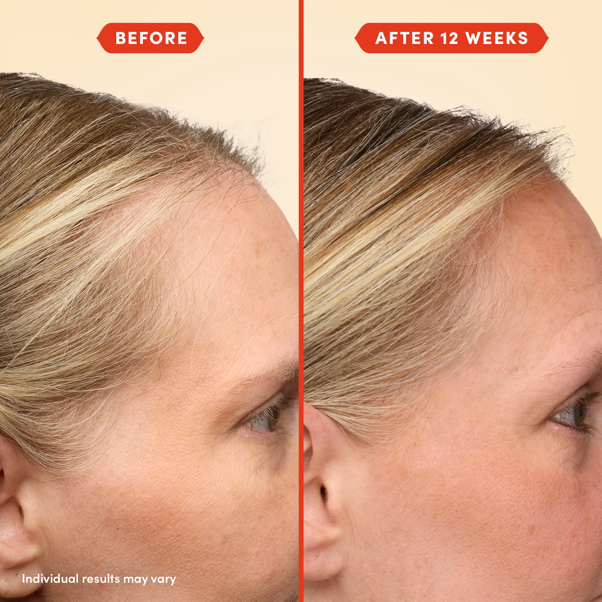 HoliRoots™ Hair Oil - Image 12