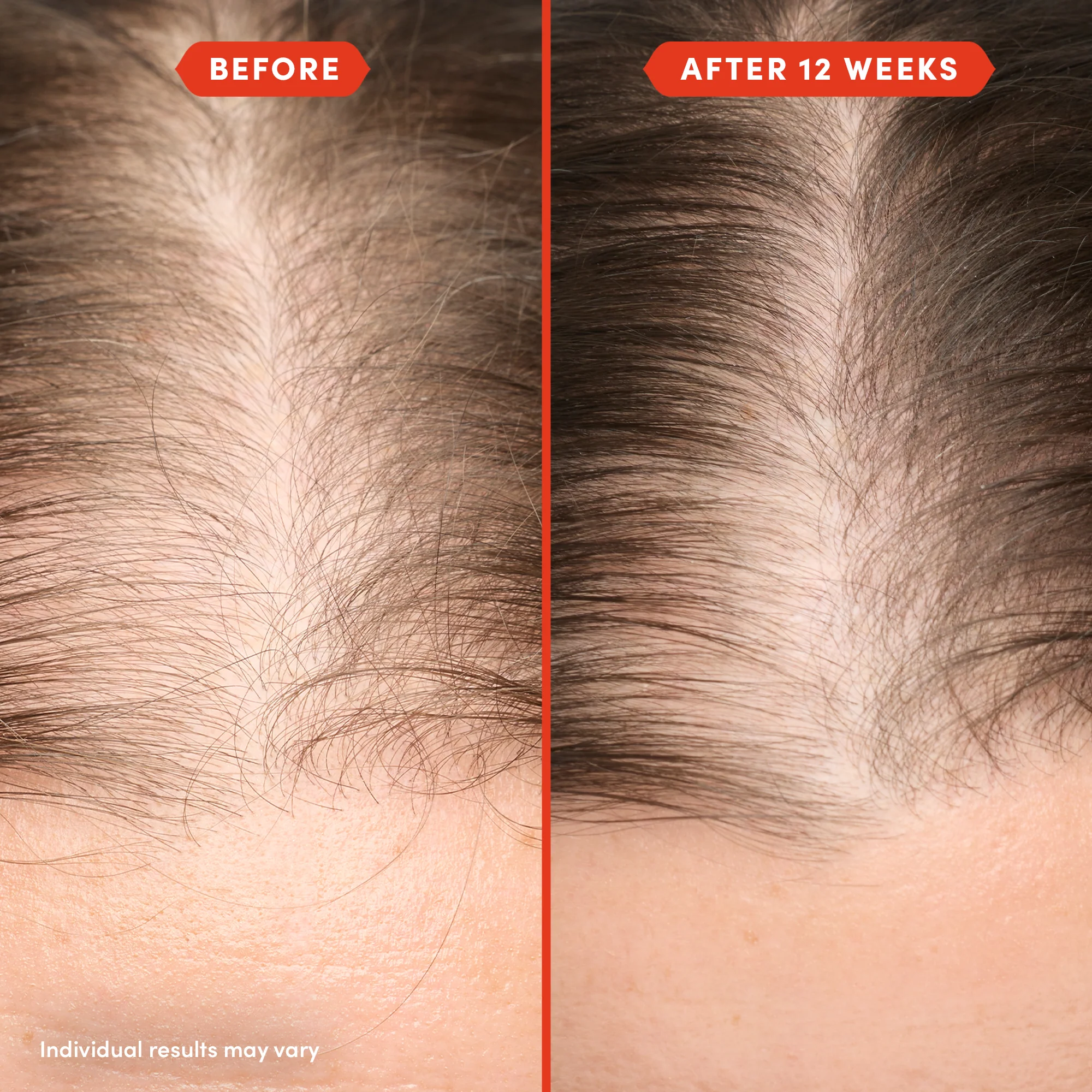 HoliRoots™ Hair Oil - Image 7