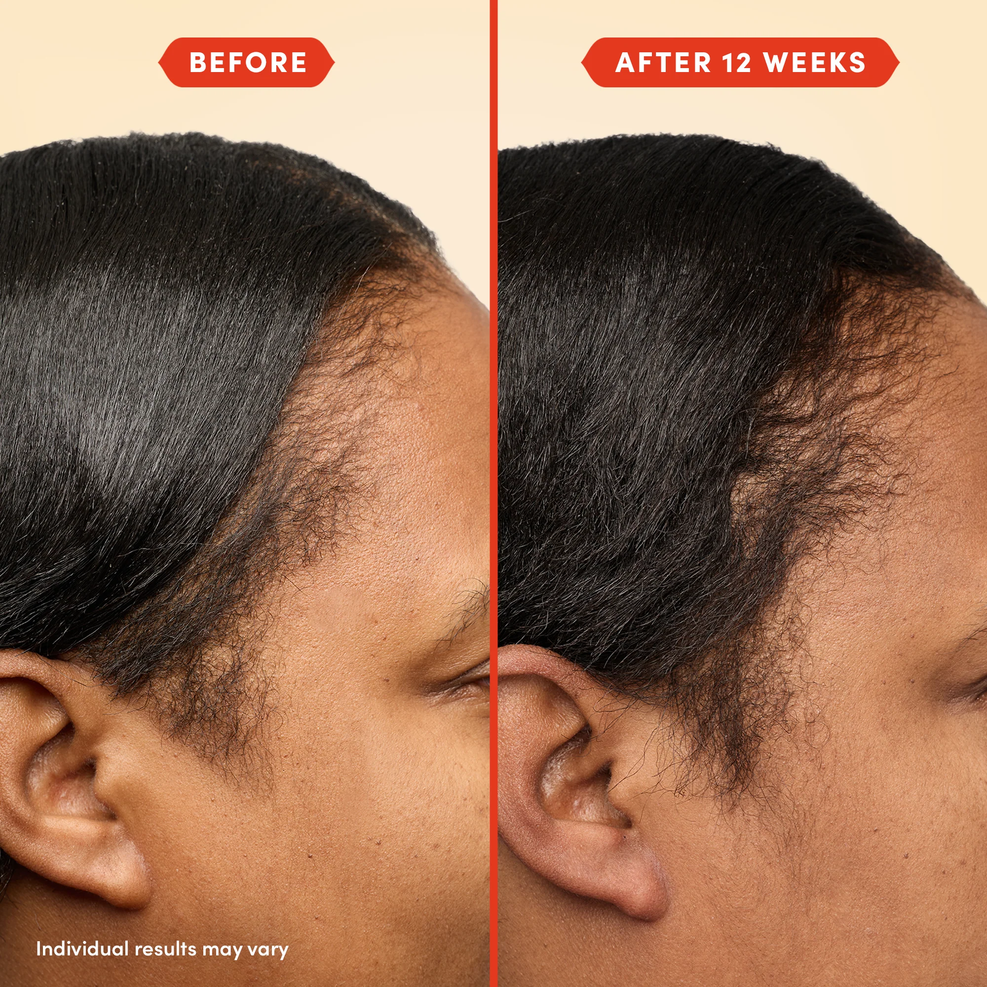 HoliRoots™ Hair Oil - Image 9