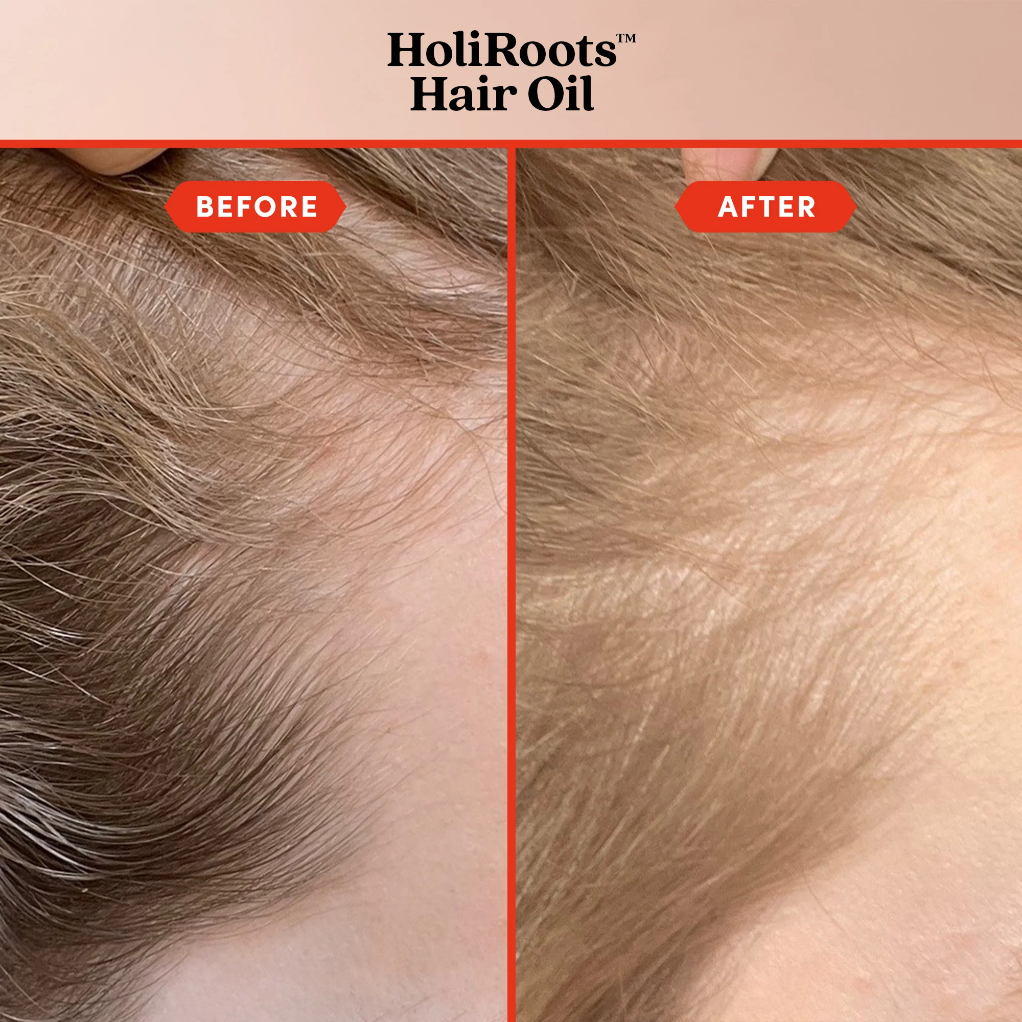 Where Hair Roars - Image 8