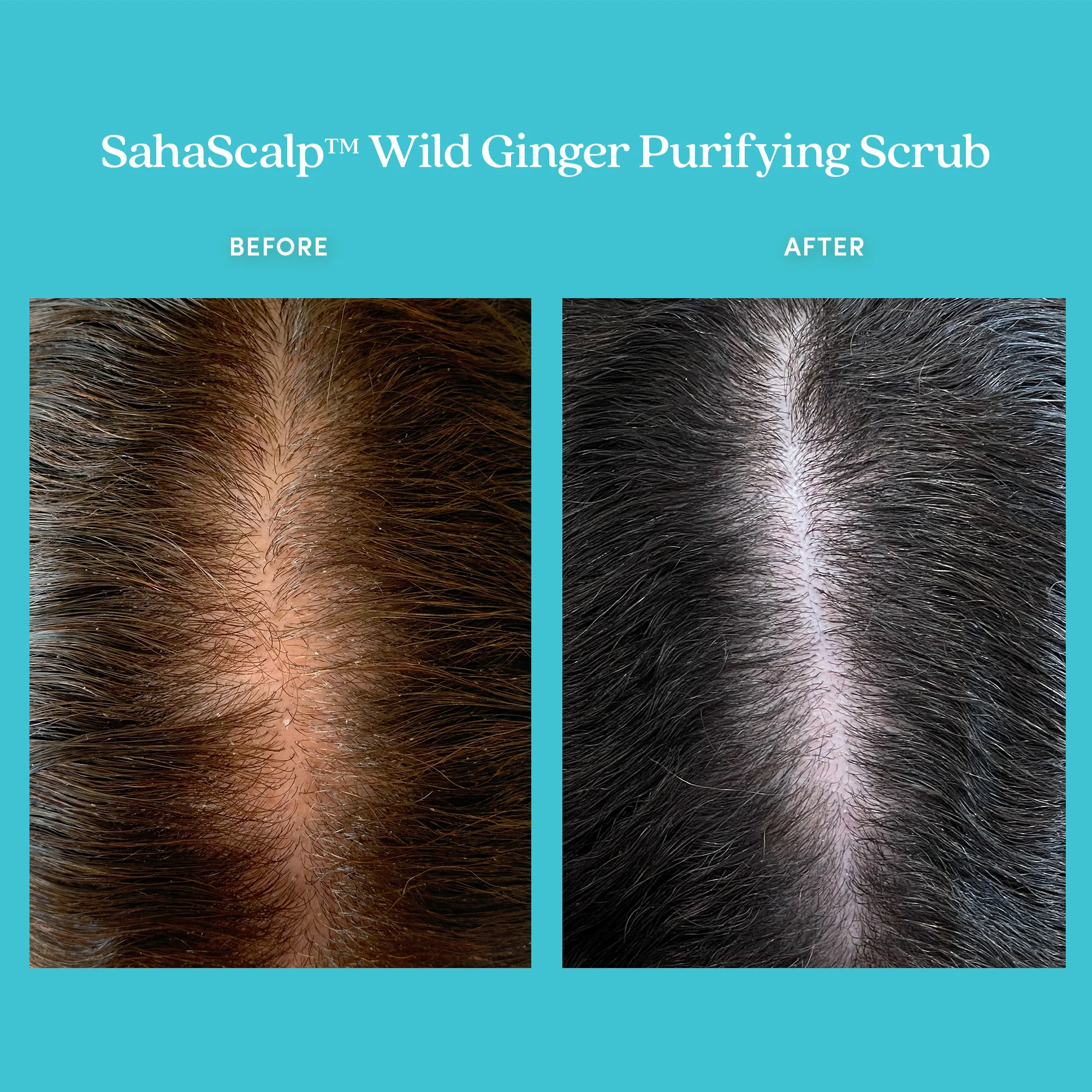 SahaScalp™ Wild Ginger Purifying Scrub - Image 4